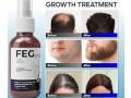 feg-plus-hair-growth-spray-price-in-kot-ghulam-muhammad-03055997199-small-0