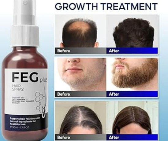 feg-plus-hair-growth-spray-price-in-kot-ghulam-muhammad-03055997199-big-0